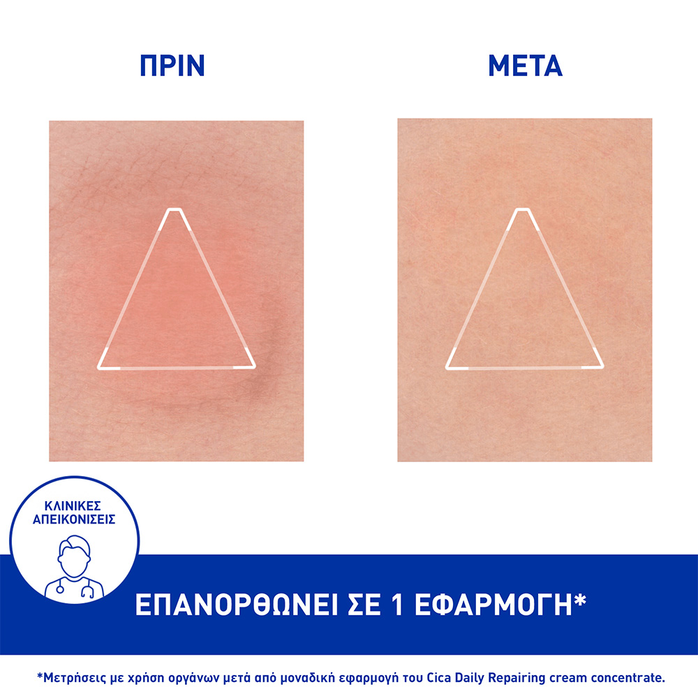 URIAGE - CICA DAILY Repairing Cream Concentre - 50ml